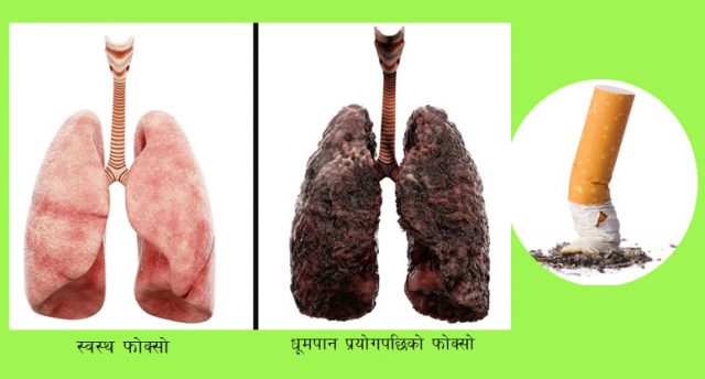 फोक्सोमा धूम्रपानले पुर्‍याएको क्षति निको पार्ने चमत्कारी उपाय पत्ता लाग्यो